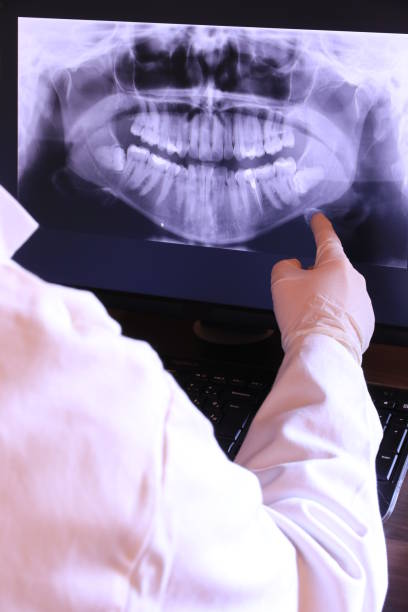 Best Emergency Dental Care for Broken or Chipped Teeth in Port Angeles, WA