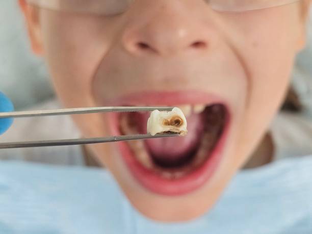 Best Cosmetic Emergency Dentistry in Port Angeles, WA